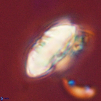 Discoaster multiradiatus 44054