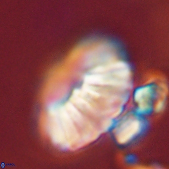 Discoaster multiradiatus 44055