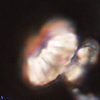 Discoaster multiradiatus 44056