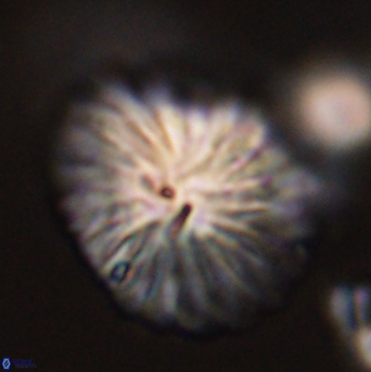 Discoaster multiradiatus 44057