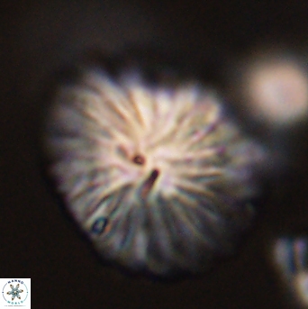 Discoaster multiradiatus 44057