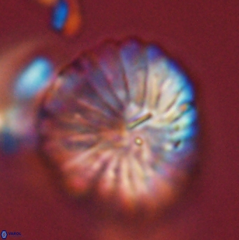 Discoaster multiradiatus 44059