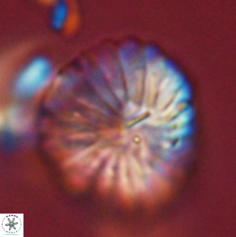 Discoaster multiradiatus 44059