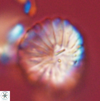 Discoaster multiradiatus 44060