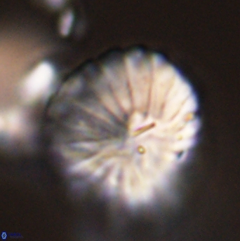 Discoaster multiradiatus 44061