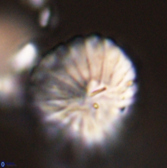 Discoaster multiradiatus 44062