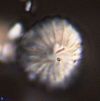 Discoaster multiradiatus 44063