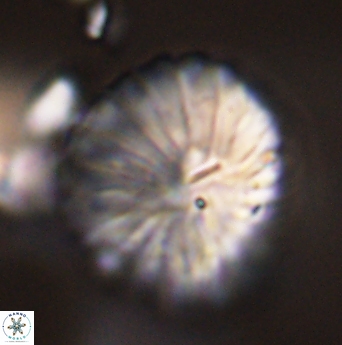 Discoaster multiradiatus 44063