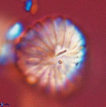Discoaster multiradiatus 44064