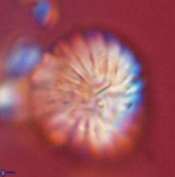 Discoaster multiradiatus 44065