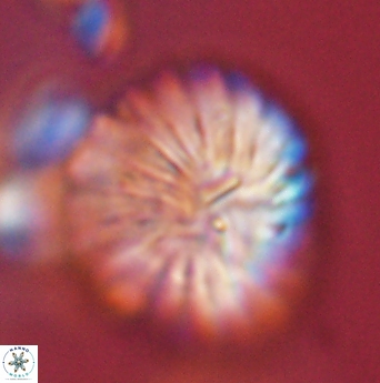 Discoaster multiradiatus 44065
