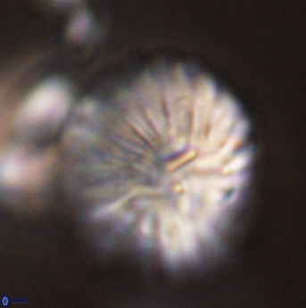 Discoaster multiradiatus 44066