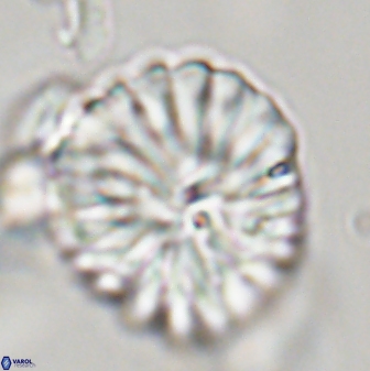Discoaster multiradiatus 44067