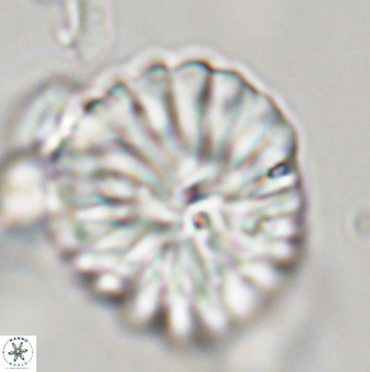 Discoaster multiradiatus 44067