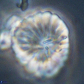 Discoaster multiradiatus 44069