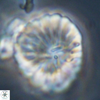 Discoaster multiradiatus 44069