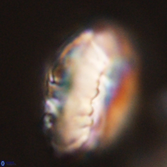Discoaster multiradiatus 44166