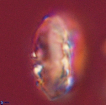 Discoaster multiradiatus 44168