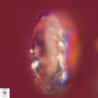 Discoaster multiradiatus 44168