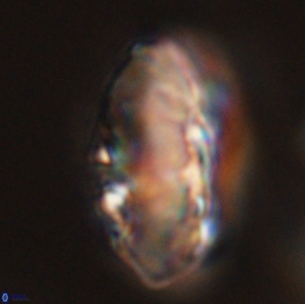 Discoaster multiradiatus 44169