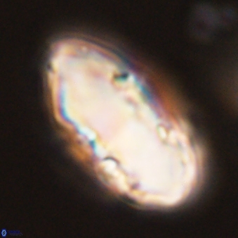 Discoaster multiradiatus 44170