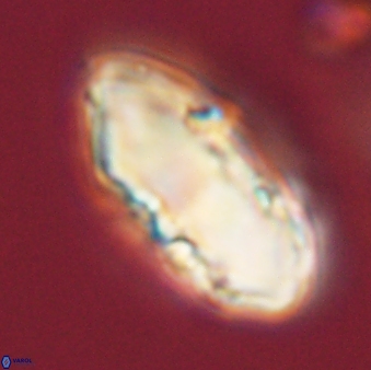 Discoaster multiradiatus 44171