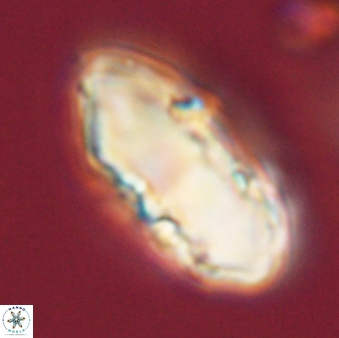 Discoaster multiradiatus 44171