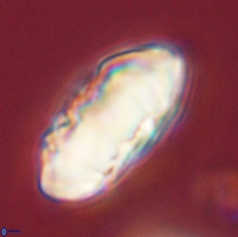 Discoaster multiradiatus 44172