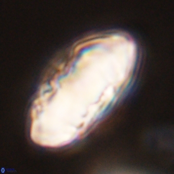 Discoaster multiradiatus 44173