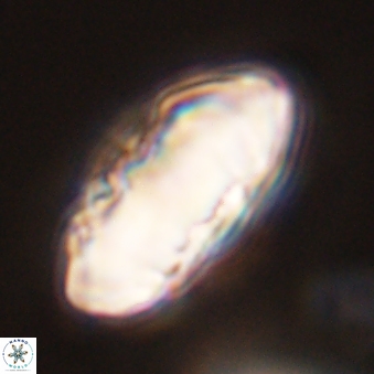 Discoaster multiradiatus 44173