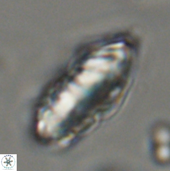 Discoaster multiradiatus 44174