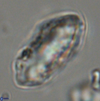 Discoaster multiradiatus 44175