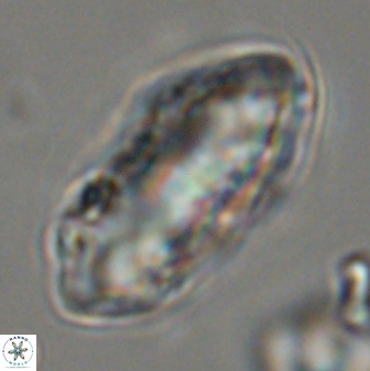 Discoaster multiradiatus 44175
