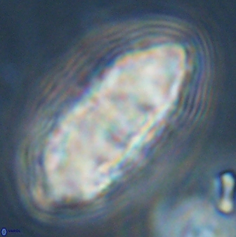 Discoaster multiradiatus 44176