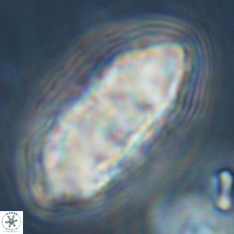 Discoaster multiradiatus 44176