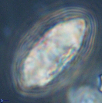 Discoaster multiradiatus 44177