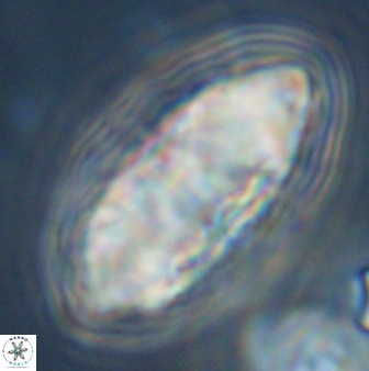 Discoaster multiradiatus 44177