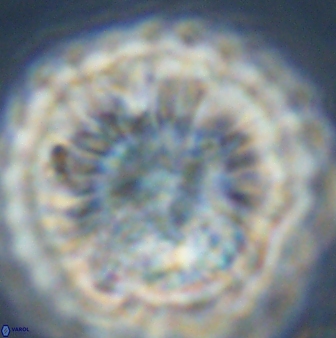 Discoaster multiradiatus 44179