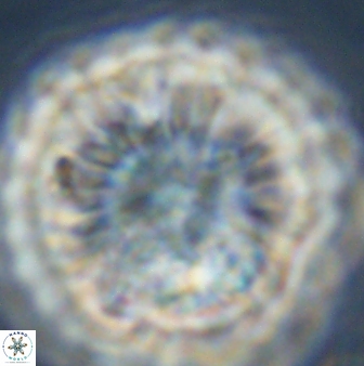 Discoaster multiradiatus 44179