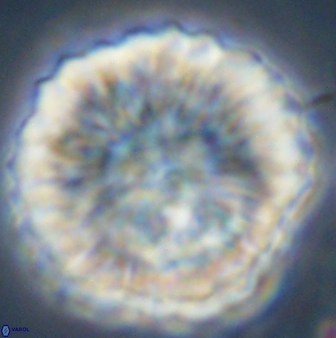 Discoaster multiradiatus 44180