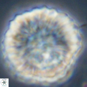 Discoaster multiradiatus 44180