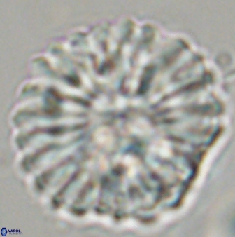Discoaster multiradiatus 44182