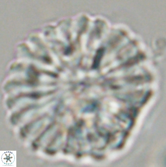 Discoaster multiradiatus 44184