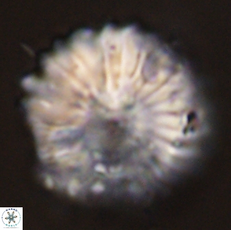 Discoaster multiradiatus 44189