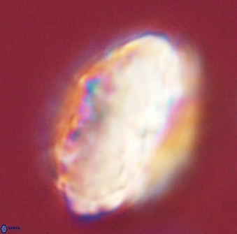 Discoaster multiradiatus 44194