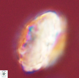 Discoaster multiradiatus 44194