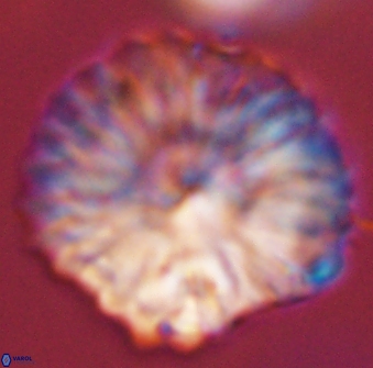 Discoaster multiradiatus 44195