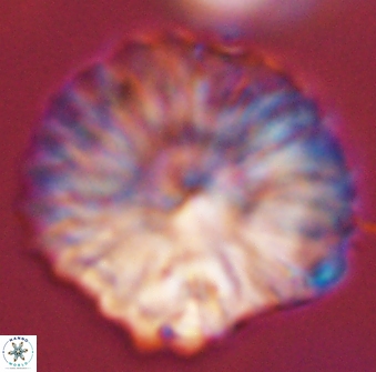 Discoaster multiradiatus 44195