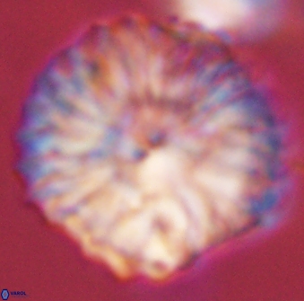 Discoaster multiradiatus 44198