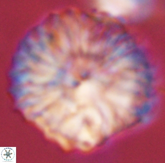 Discoaster multiradiatus 44198